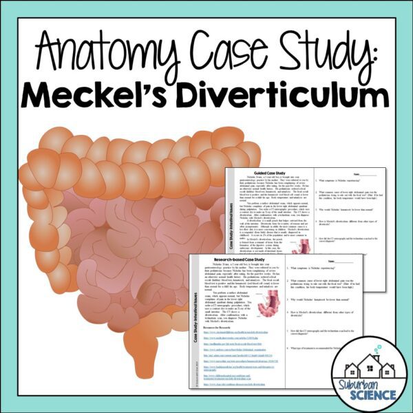 Case Study Anatomy and Physiology - Meckel's Diverticulum