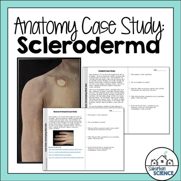 Anatomy and Physiology Case Study - Scleroderma